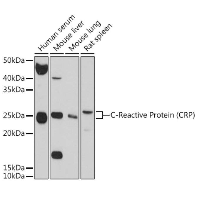 C-Reactive Protein (CRP) Rabbit Polyclonal Antibody