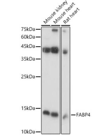 FABP4 Rabbit Polyclonal Antibody
