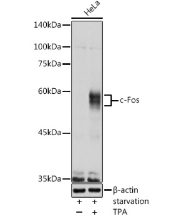 c-Fos Rabbit Polyclonal Antibody