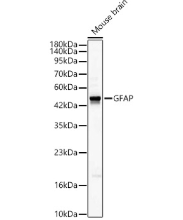 GFAP Rabbit Polyclonal Antibody