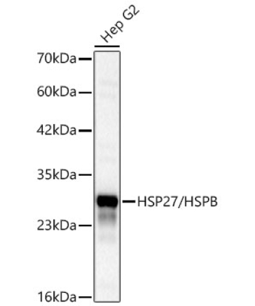 HSP27/HSPB1 Rabbit Polyclonal Antibody