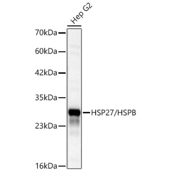 HSP27/HSPB1 Rabbit Polyclonal Antibody