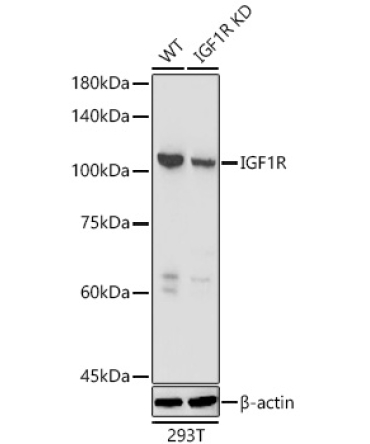 IGF1R Rabbit Polyclonal Antibody [KD Validated]