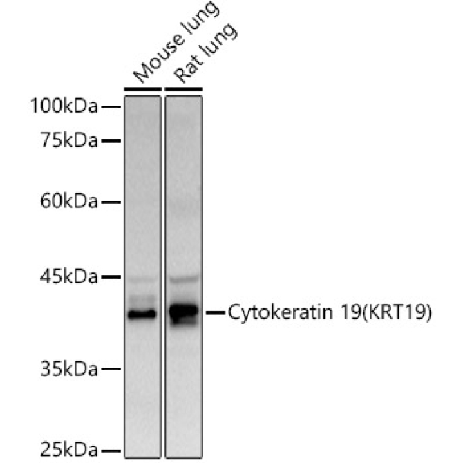 Cytokeratin 19 (KRT19) Rabbit Polyclonal Antibody