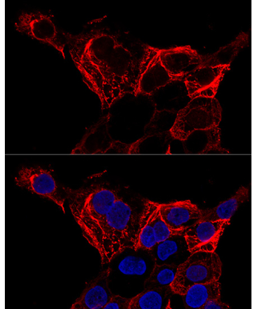 Cytokeratin 20 (KRT20) Rabbit Polyclonal Antibody