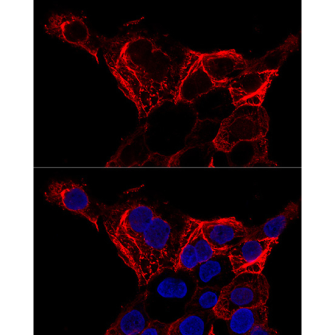 Cytokeratin 20 (KRT20) Rabbit Polyclonal Antibody