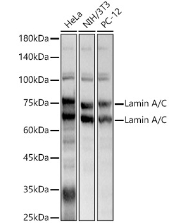 Lamin A/C Rabbit Polyclonal Antibody