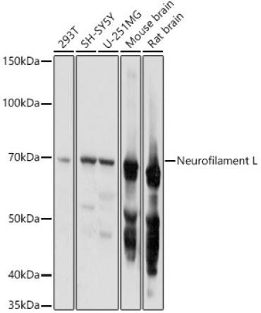 Neurofilament L Rabbit Polyclonal Antibody