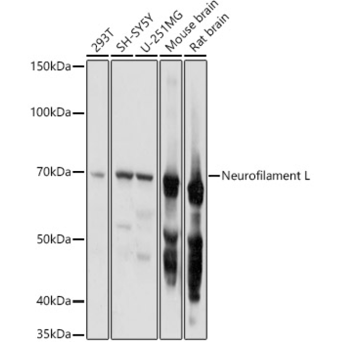Neurofilament L Rabbit Polyclonal Antibody
