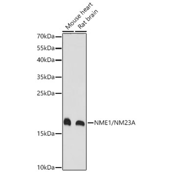 NME1/NM23A Rabbit Polyclonal Antibody