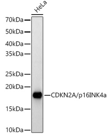 CDKN2A/p16INK4a Rabbit Polyclonal Antibody [KO Validated]