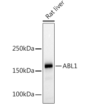 c-Abl Rabbit Polyclonal Antibody