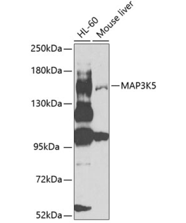 MAP3K5 Rabbit Polyclonal Antibody