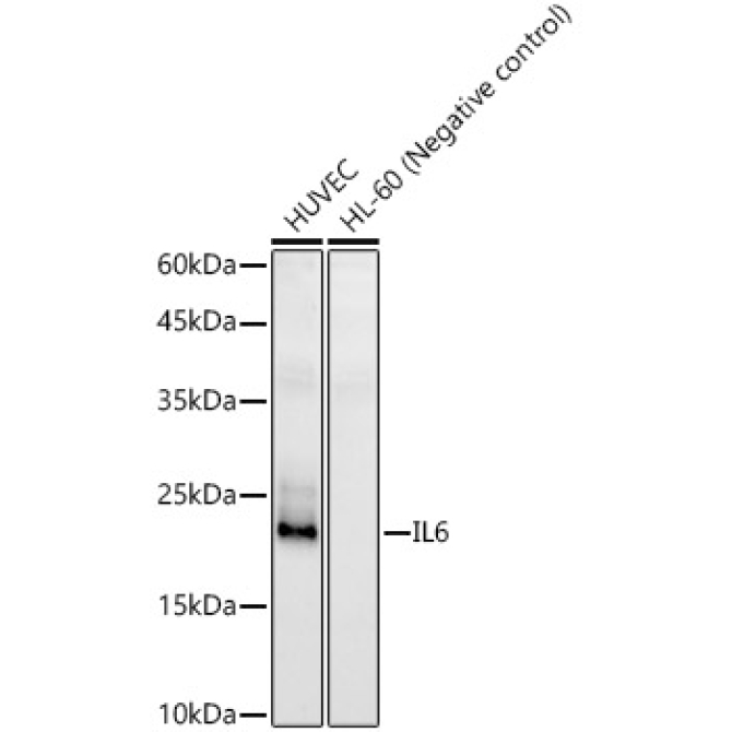 IL6 Rabbit Polyclonal Antibody