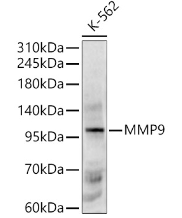 MMP9 Rabbit Polyclonal Antibody