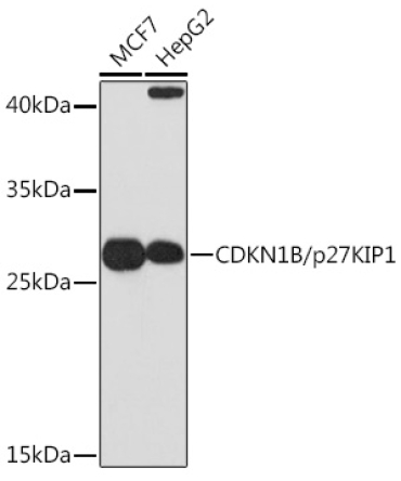 CDKN1B/p27KIP1 Rabbit Polyclonal Antibody