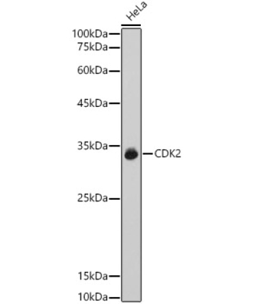CDK2 Rabbit Polyclonal Antibody [KO Validated]