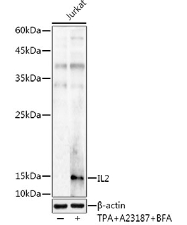 IL2 Rabbit Polyclonal Antibody