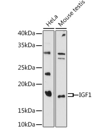 IGF1 Rabbit Polyclonal Antibody