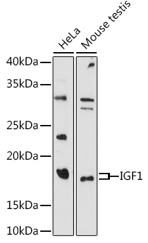 IGF1 Rabbit Polyclonal Antibody