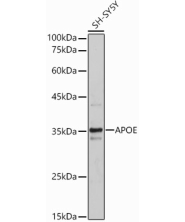 APOE Rabbit Polyclonal Antibody