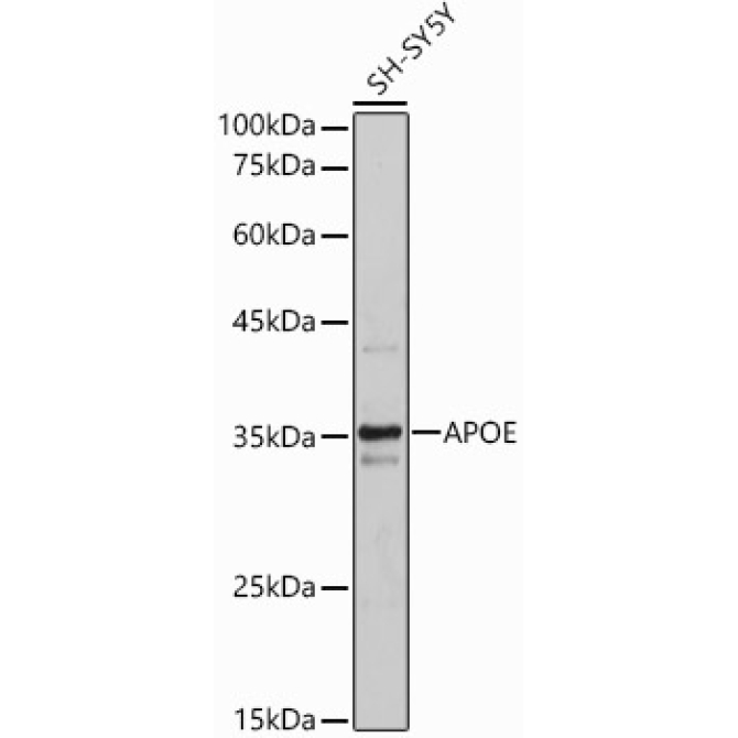 APOE Rabbit Polyclonal Antibody
