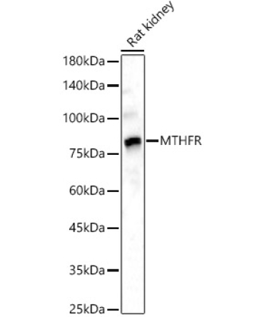 MTHFR Rabbit Polyclonal Antibody