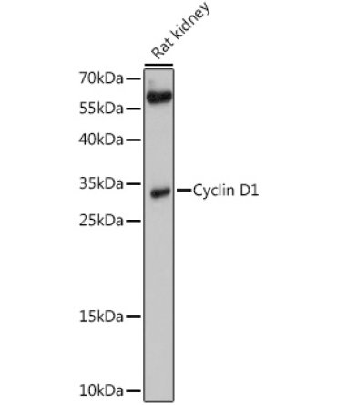 Cyclin D1 Rabbit Polyclonal Antibody