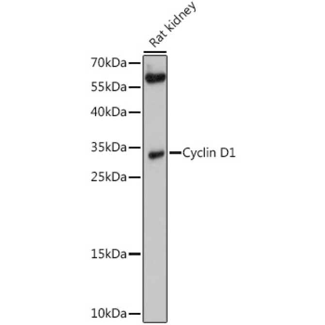 Cyclin D1 Rabbit Polyclonal Antibody