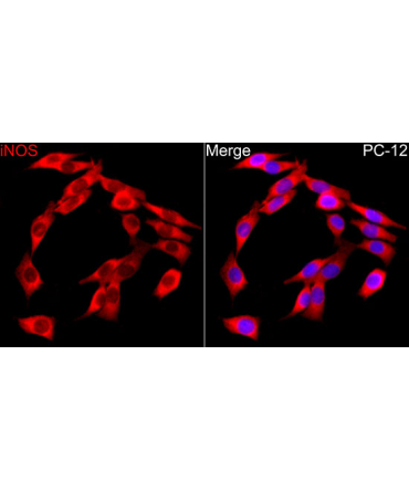 iNOS Rabbit Polyclonal Antibody