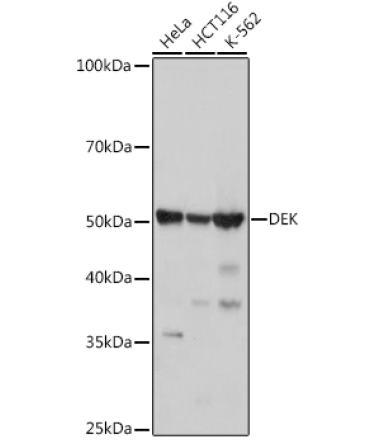 DEK Rabbit Monoclonal Antibody