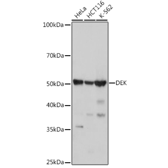 DEK Rabbit Monoclonal Antibody