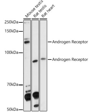 Androgen Receptor Rabbit Polyclonal Antibody