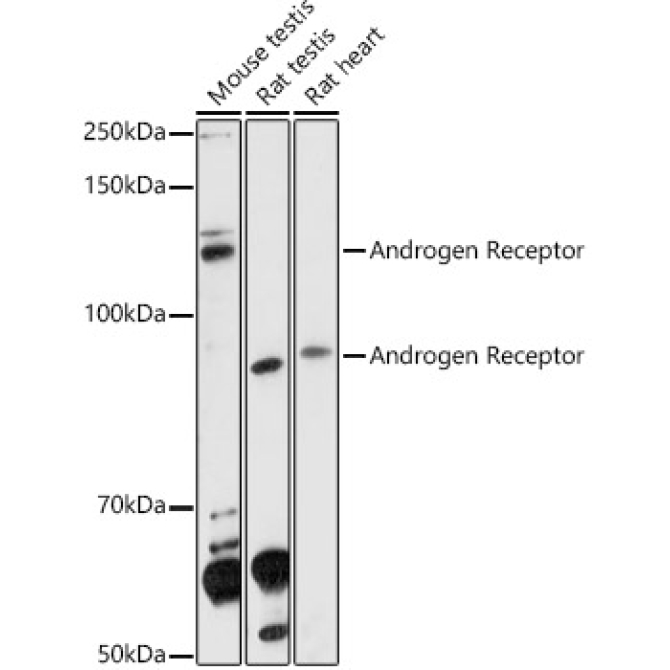 Androgen Receptor Rabbit Polyclonal Antibody