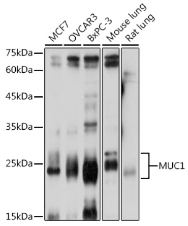 MUC1 Rabbit Polyclonal Antibody