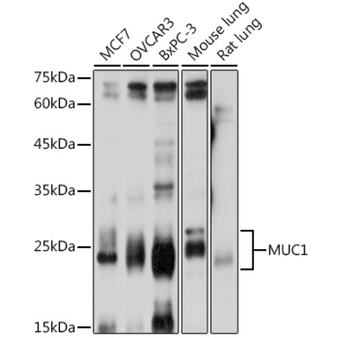 MUC1 Rabbit Polyclonal Antibody