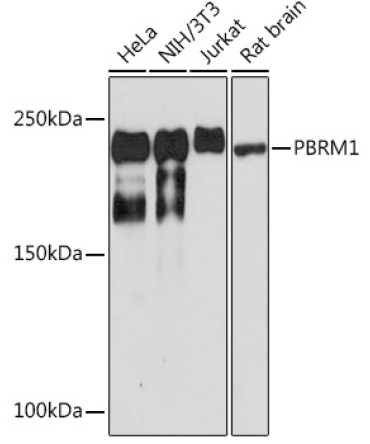 PBRM1 Rabbit Monoclonal Antibody