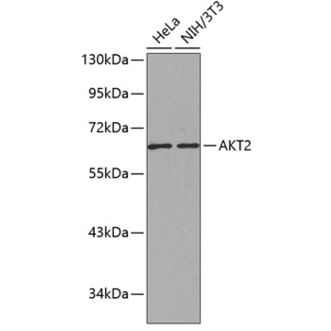AKT2 Rabbit Polyclonal Antibody