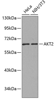 AKT2 Rabbit Polyclonal Antibody