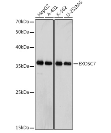 EXOSC7 Rabbit Monoclonal Antibody