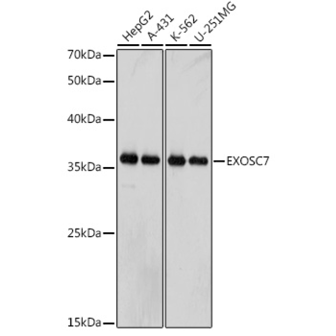 EXOSC7 Rabbit Monoclonal Antibody