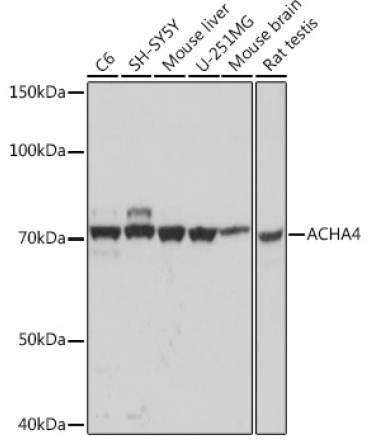 ACHA4 Rabbit Monoclonal Antibody