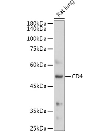 CD4 Rabbit Polyclonal Antibody