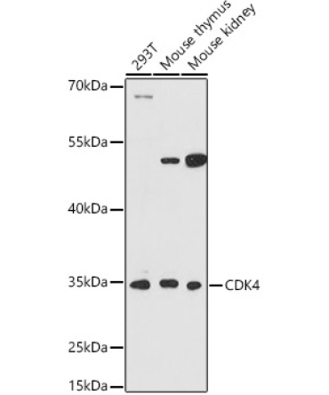 CDK4 Rabbit Polyclonal Antibody