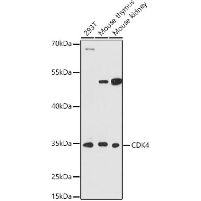 CDK4 Rabbit Polyclonal Antibody