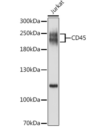 CD45 Rabbit Polyclonal Antibody