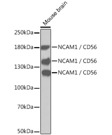 NCAM1 / CD56 Rabbit Polyclonal Antibody