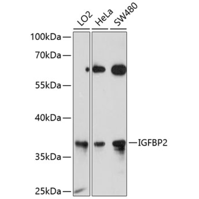 IGFBP2 Rabbit Polyclonal Antibody