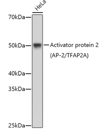 Activator protein 2 (AP-2/TFAP2A) Rabbit Polyclonal Antibody