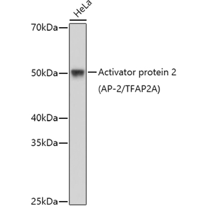 Activator protein 2 (AP-2/TFAP2A) Rabbit Polyclonal Antibody
